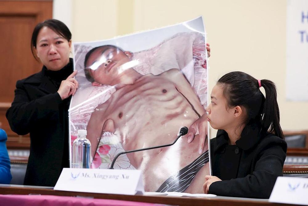 Xu Dawei, stanovnik provincije Liaoning, 2009. godine je preminuo od mučenja u 33. godini starosti. Njegova supruga i kćerka su svjedočile na forumu.