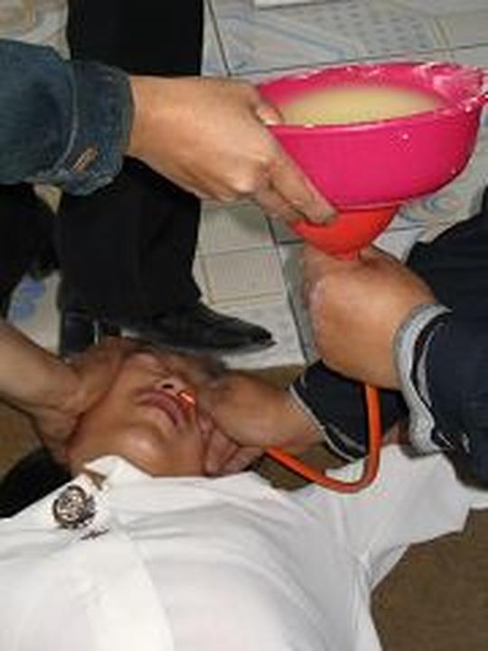 Rekonstrukcija mučenja: prisilno hranjenje