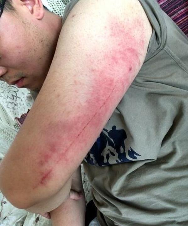 Sin gospođe Zhan nakon što ga je policija pretukla