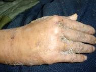 Fotografije snimljene nakon što je gospodin Vang pobegao iz bolnice