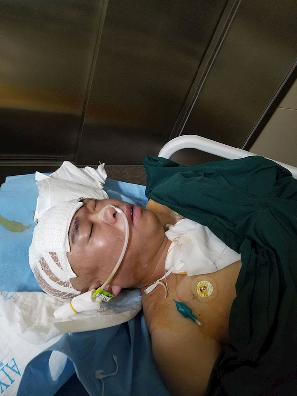 Gosp. Yao nakon kraniotomije