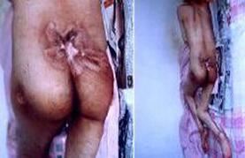 Kuova kičma, otvorena rana